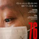 76天
